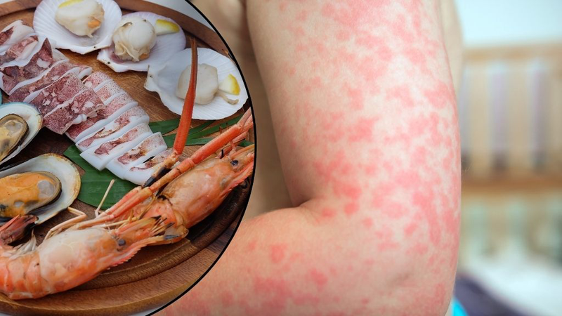 Ốc giác: Ăn có bổ dưỡng không? Lưu ý gì khi ăn? 4