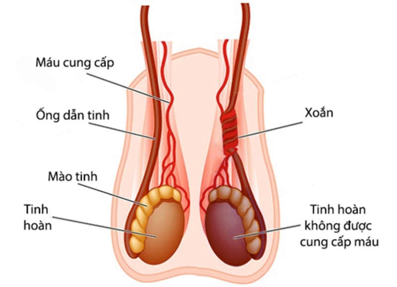 Ống dẫn tinh 1