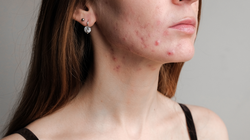  Paraben là gì? Paraben có nguy hiểm không? 3