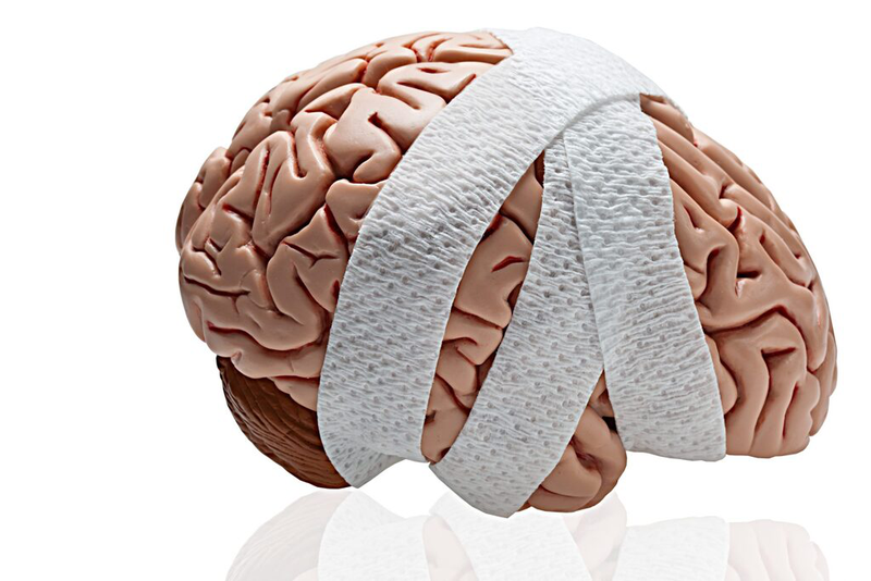 Phác đồ điều trị chấn thương sọ não như thế nào? Cách phòng ngừa chấn thương sọ não 3