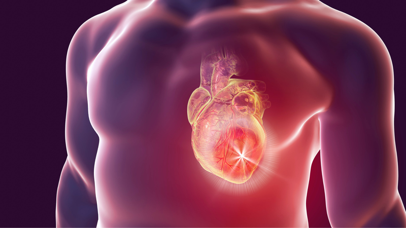 Phác đồ điều trị nhồi máu cơ tim như thế nào? Biện pháp phòng bệnh hiệu quả 3