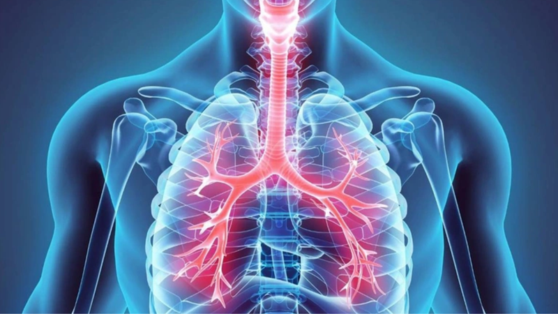 Phân loại mức độ nặng của COPD theo chỉ số FEV1 1