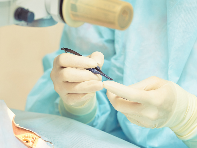 Phẫu thuật đục thuỷ tinh thể là thủ thuật như thế nào?