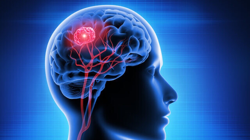 Phẫu thuật sọ não: Hiểu rõ quy trình, rủi ro và biện pháp phòng ngừa biến chứng 1
