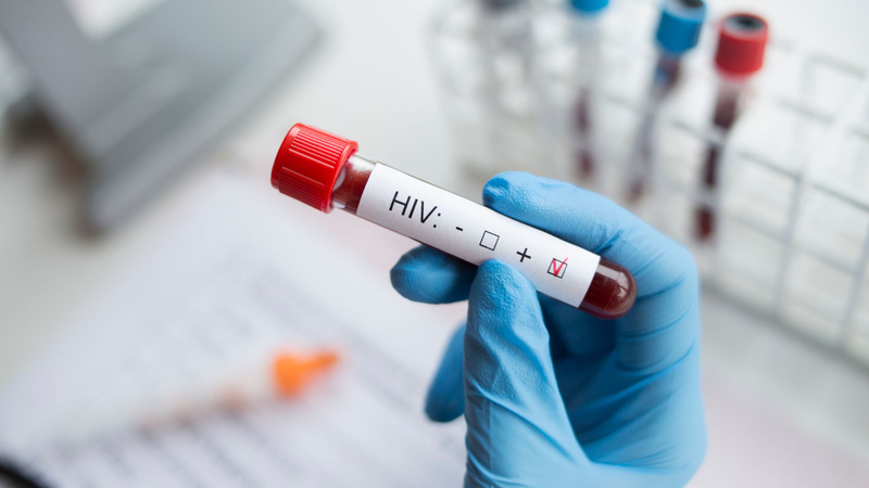 Phơi nhiễm HIV bao lâu​ thì phát hiện được? Tất cả những điều bạn nên biết 2