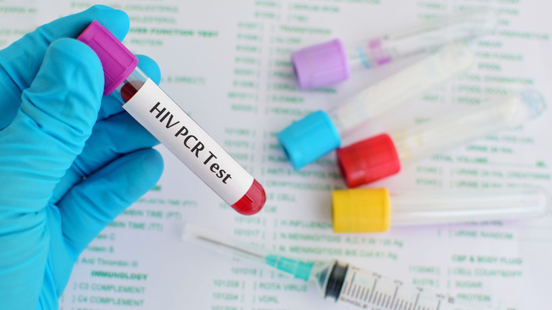 Phơi nhiễm HIV bao lâu​ thì phát hiện được? Tất cả những điều bạn nên biết 3