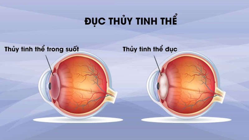 Phòng tránh các bệnh về mắt bằng cách nào để đôi mắt luôn khỏe mạnh? 2