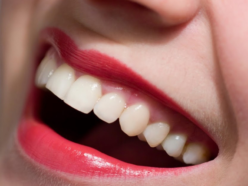 Phục hình răng là gì? Có những phương pháp phục hình răng nào?-2