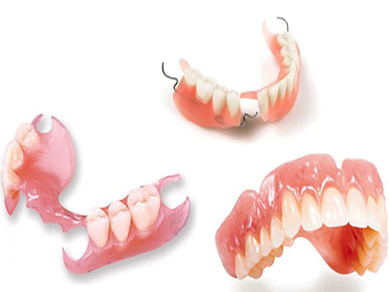 Phục hình răng là gì? Có những phương pháp phục hình răng nào?-3
