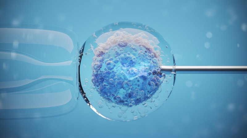 Phương pháp IMSI – Kỹ thuật chọn lọc tinh trùng cho IVF/ICSI 2