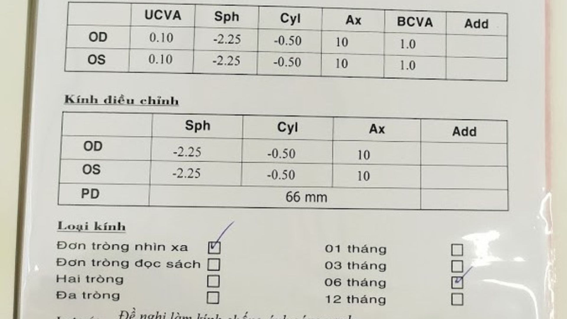 Plano là gì và một số chỉ số khác trong kết quả đo mắt 2