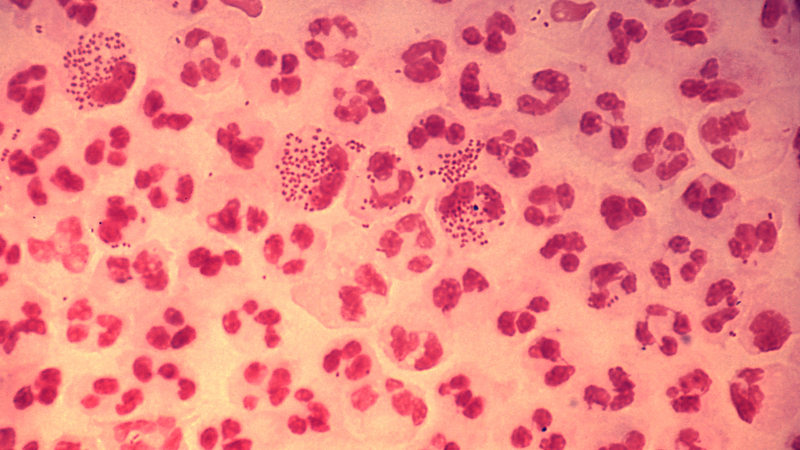 Quan hệ bằng miệng có nguy cơ lây bệnh gì? Cách phòng ngừa STIs khi quan hệ bằng miệng 3