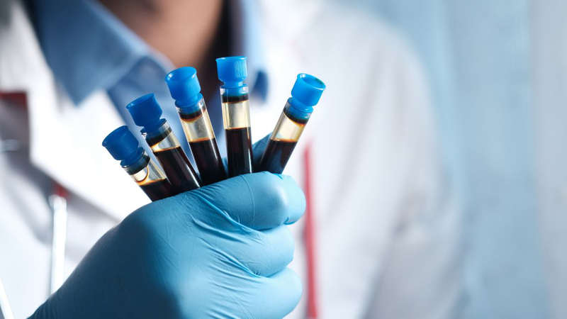 Có những lưu ý trước, trong và sau lấy máu cần được bác sĩ tư vấn