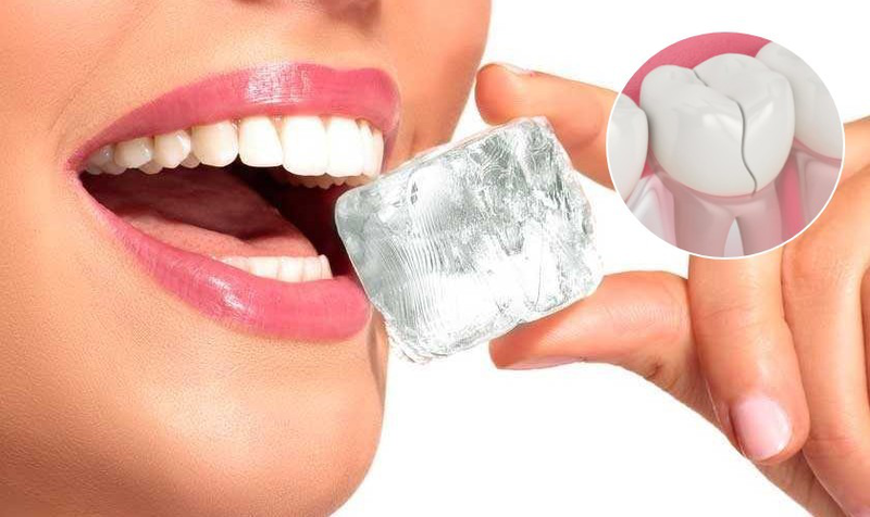 Răng bị nứt ngang là tình trạng gì? Răng bị nứt ngang phải làm sao? 2