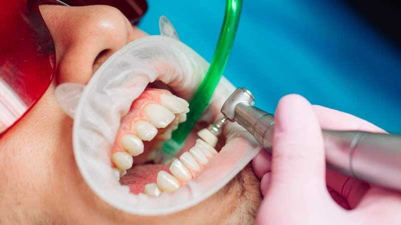 Răng cao răng thấp làm thế nào để khắc phục? 4