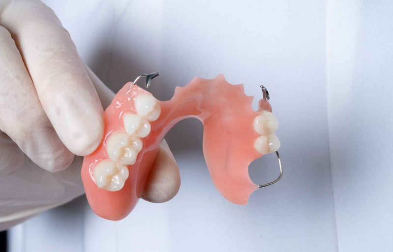 Răng giả tháo lắp là gì? Ưu và nhược điểm của răng giả tháo lắp 1