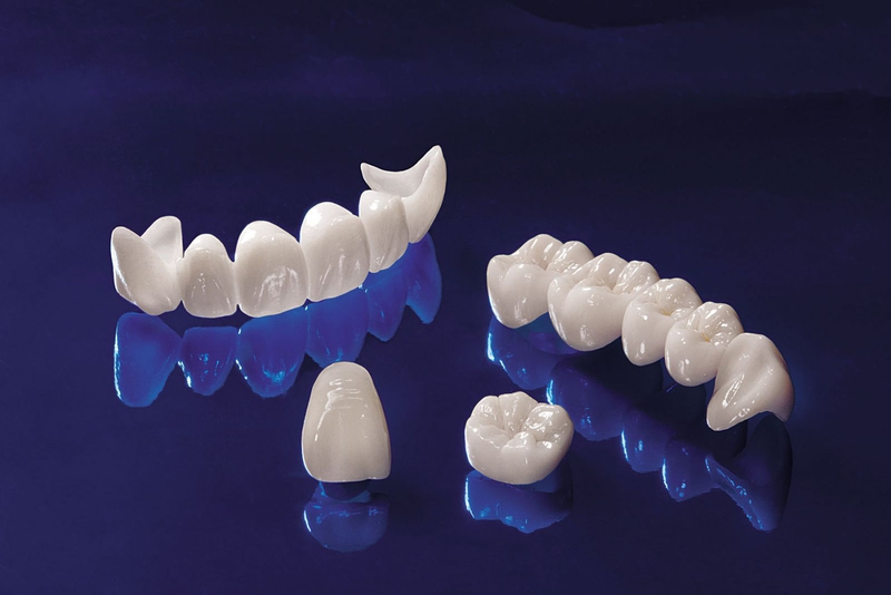 Răng sứ ceramill có mấy loại? Răng sứ ceramill có tốt không? 1