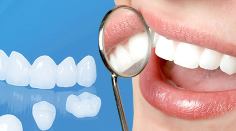 Răng sứ ceramill có mấy loại? Răng sứ ceramill có tốt không? 2