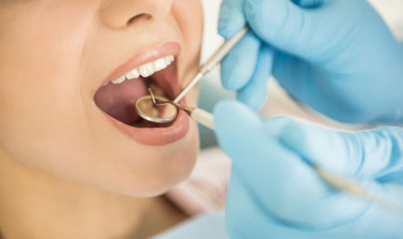 Răng sứ có bị ố vàng không? Những điều bạn cần biết 4