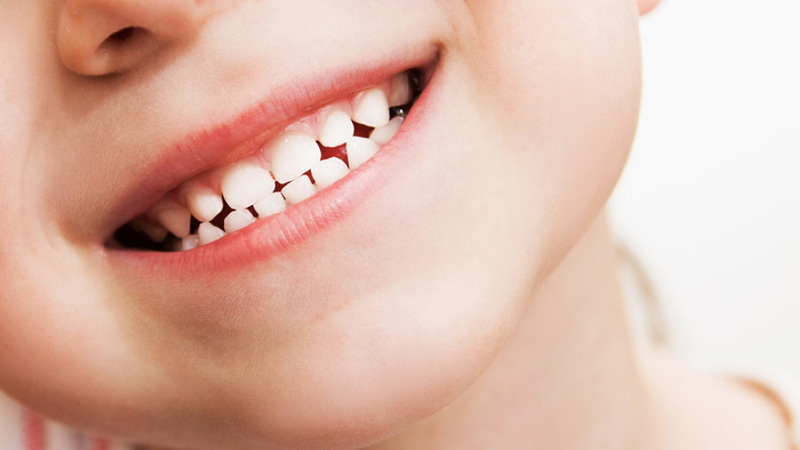 Răng sữa có chân không? Răng sữa khác gì răng vĩnh viễn? 1