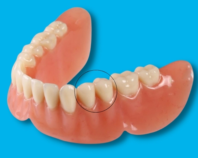Tìm hiểu về răng tiền hàm và các vấn đề có thể gặp phải 2