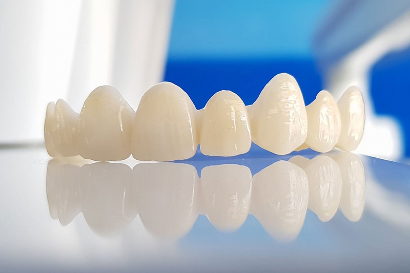 Răng sứ Zirconia có màu sắc trắng tự nhiên giống như màu ngà răng và thích hợp với mô mềm trong khoang miệng