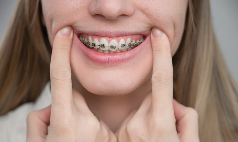 Răng vĩnh viễn mọc lệch vào trong: Nguyên nhân và dấu hiệu nhận biết 3