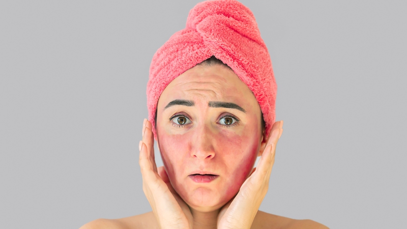 retinol-boi-tren-nen-da-kho-hay-am-cach-dung-chuan-giup-da-khoe-dep-4.jpg