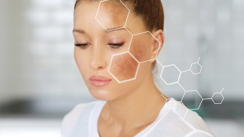 retinol-tri-nam-tan-nhang-co-hieu-qua-khong-giai-ma-cong-dung-tu-a-z-1.jpg