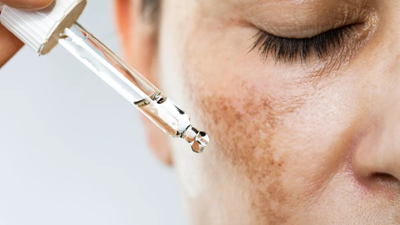 Retinol và Tretinoin khác nhau như thế nào? Những lưu ý khi dùng 1