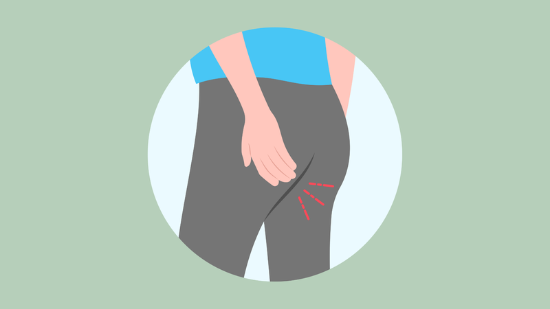 Rò hậu môn xuyên cơ thắt: Thông tin quan trọng cần biết 2