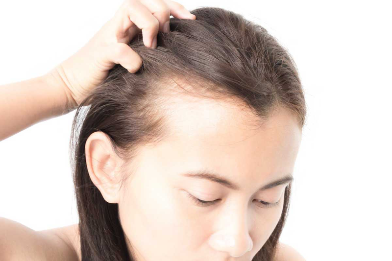 Giải đáp tất - tần - tật thắc mắc về tình trạng rụng tóc nhiều 1