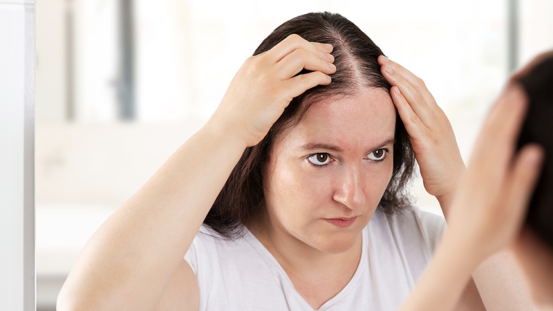 Giải đáp tất - tần - tật thắc mắc về tình trạng rụng tóc nhiều 2