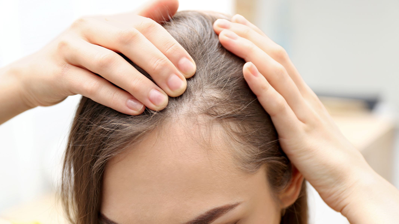 Khi xuất hiện các vùng hói khu trú, có hình tròn hoặc bầu dục, thường liên quan đến rụng tóc từng mảng, bạn cần thăm khám bác sĩ sớm