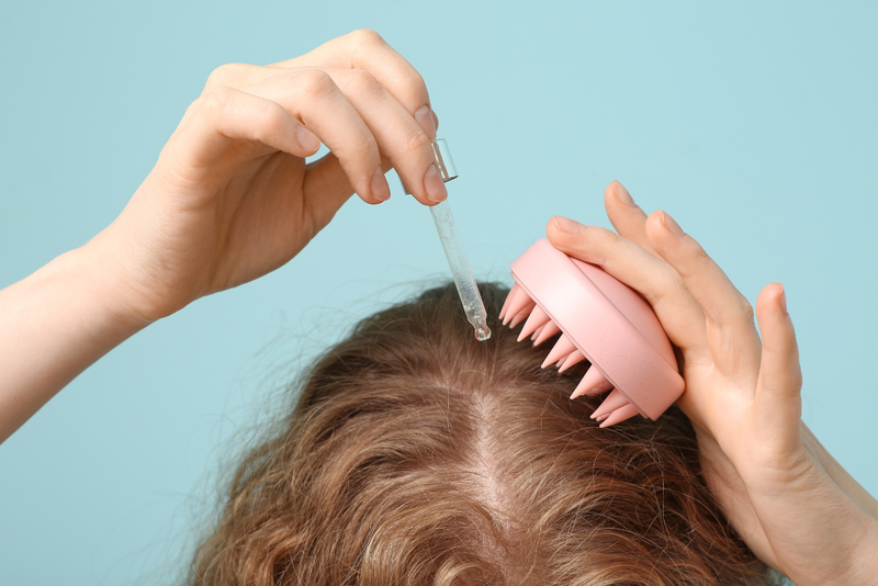 Rụng tóc nhiều ở nữ: Nguyên nhân thường gặp và cách chữa trị 4