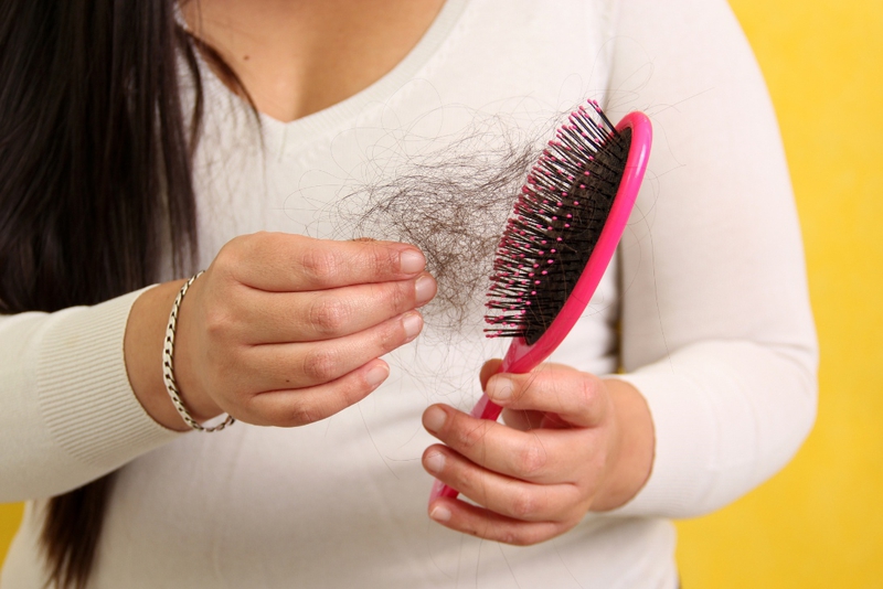 Rụng tóc nhiều ở nữ: Nguyên nhân thường gặp và cách chữa trị 3
