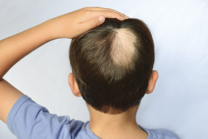 Rụng tóc ở trẻ em có đáng lo không? Nguyên nhân và cách khắc phục là gì 2