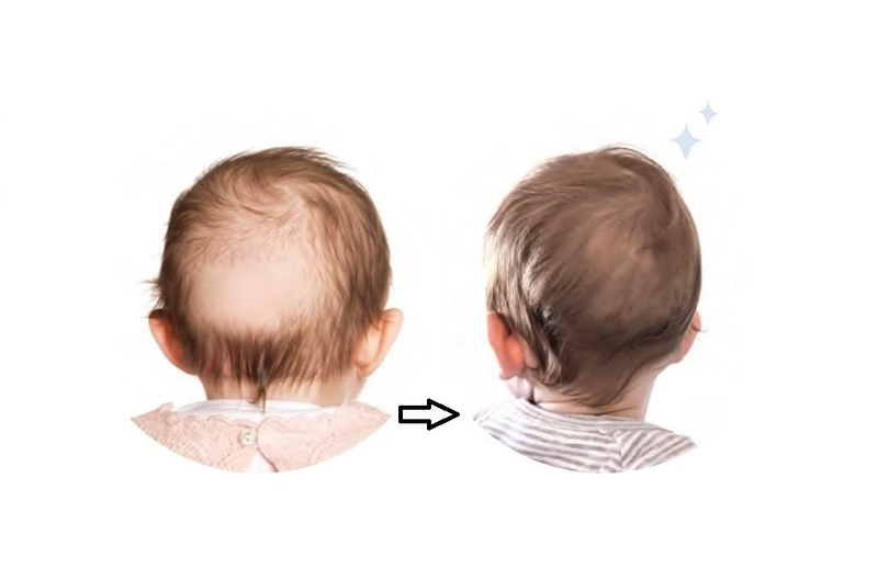 Rụng tóc ở trẻ em có đáng lo không? Nguyên nhân và cách khắc phục là gì 1
