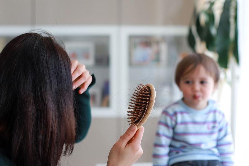 Rụng tóc sau sinh: Nguyên nhân, dấu hiệu nhận biết và cách xử lý 4