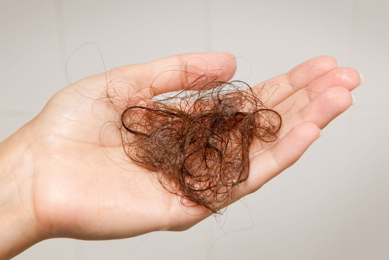 Rụng tóc toàn thể là gì? Nguyên nhân và cách chữa trị 1