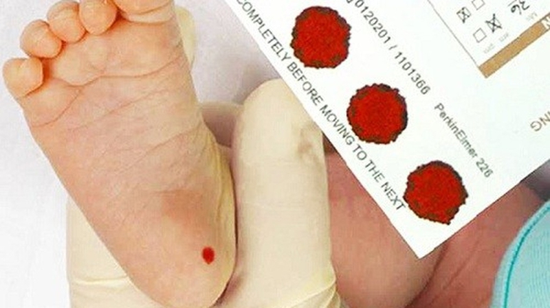 Sàng lọc máu gót chân: Hiểu biết về phương pháp sàng lọc quan trọng cho trẻ sơ sinh 1