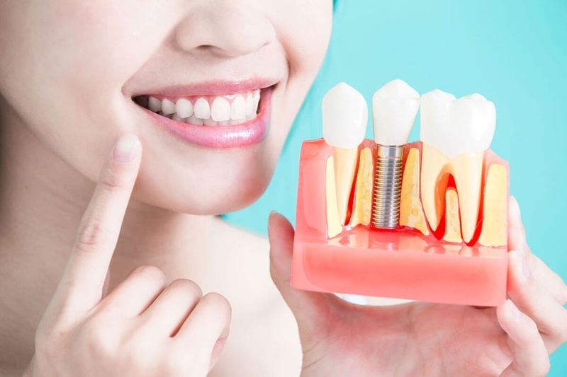 Sâu răng nặng là gì? Cách trị sâu răng nặng hiệu quả 3
