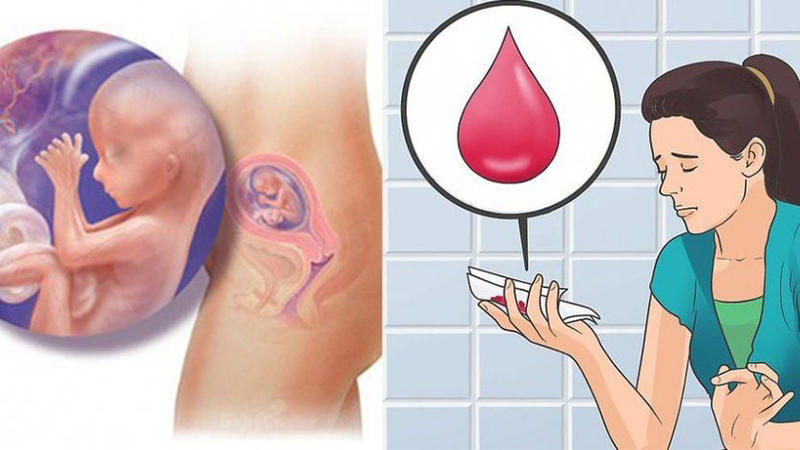 Sau sảy thai có thể ăn chua không? 1