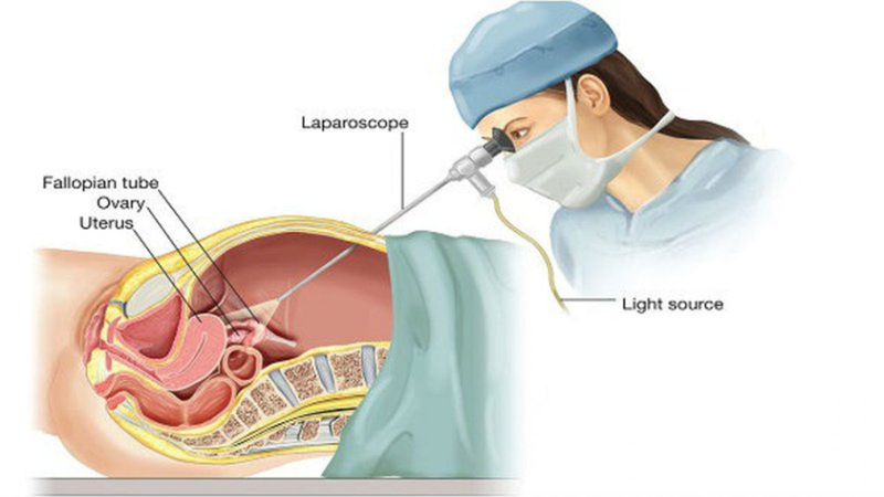 Siêu âm có phát hiện ung thư gan​? Vai trò của tầm soát ung thư gan sớm 2