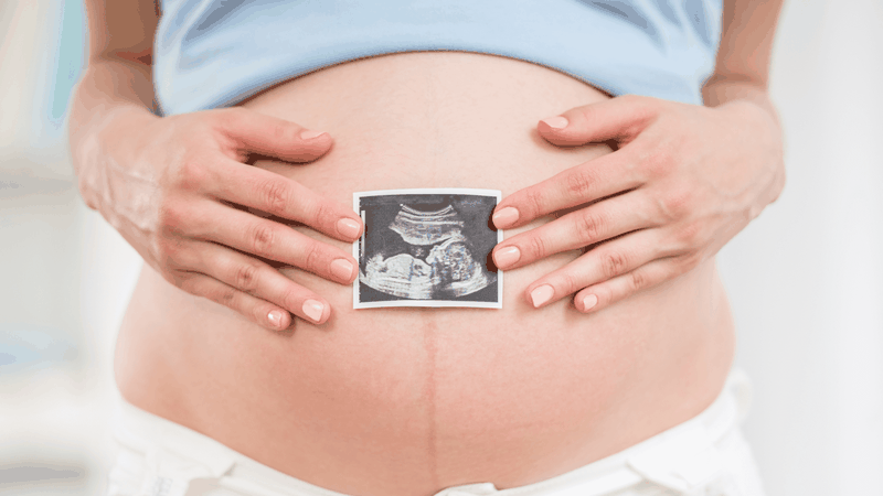 Siêu âm thai: Những điều mẹ bầu cần biết để theo dõi sức khỏe thai nhi 4