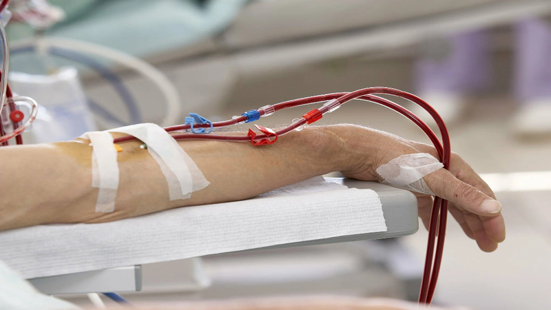 Siêu lọc máu chậm liên tục là gì? Ưu điểm và những lưu ý 2