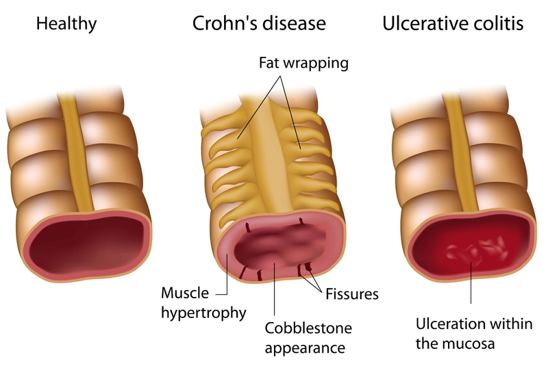 small intestine là gì 3