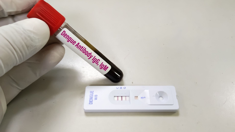Sốt xuất huyết Dengue thể não: Nguyên nhân, triệu chứng và phương pháp chẩn đoán 4