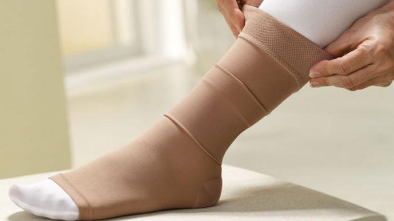 Suy giãn tĩnh mạch chân: Nguyên nhân và giải pháp điều trị hiệu quả 3