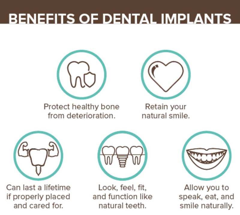 Tác hại của việc trồng răng implant có thể bạn chưa biết? 4